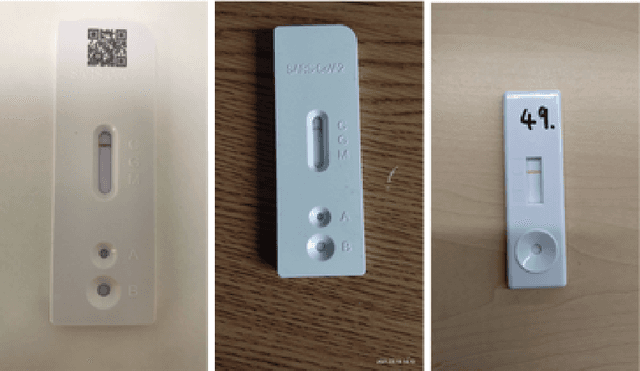 Figure 3 for SARS-CoV-2 Result Interpretation based on Image Analysis of Lateral Flow Devices