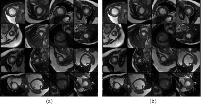 Figure 4 for Robust Image Segmentation Quality Assessment without Ground Truth