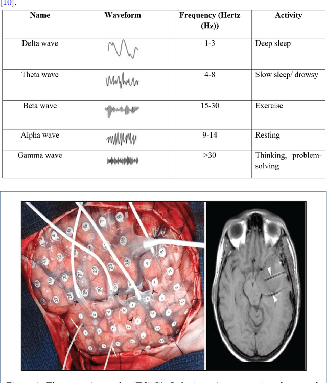 Figure 2 for Brain Signals Analysis Based Deep Learning Methods: Recent advances in the study of non-invasive brain signals