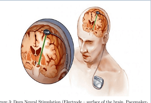 Figure 4 for Brain Signals Analysis Based Deep Learning Methods: Recent advances in the study of non-invasive brain signals