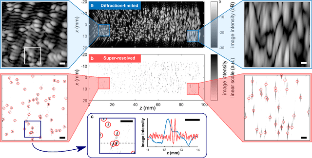 Figure 2 for Super-Resolved Microbubble Localization in Single-Channel Ultrasound RF Signals Using Deep Learning