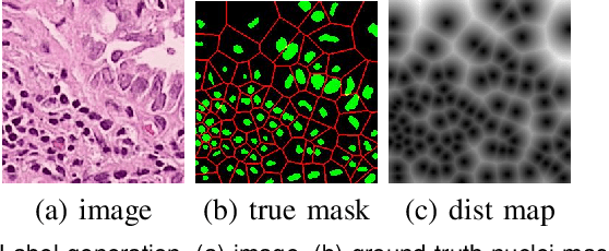 Figure 4 for Weakly Supervised Deep Nuclei Segmentation Using Partial Points Annotation in Histopathology Images