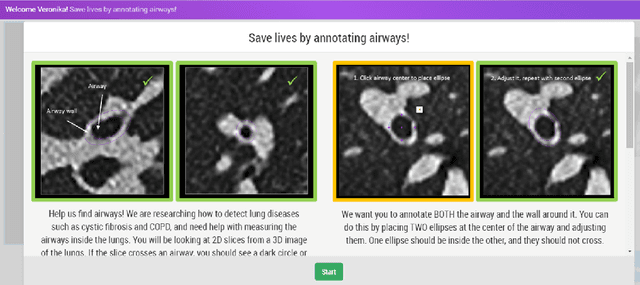 Figure 3 for Early Experiences with Crowdsourcing Airway Annotations in Chest CT