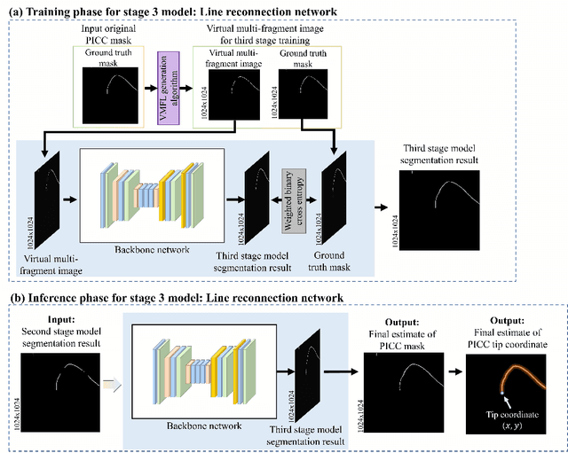 Figure 1 for Automated Precision Localization of Peripherally Inserted Central Catheter Tip through Model-Agnostic Multi-Stage Networks