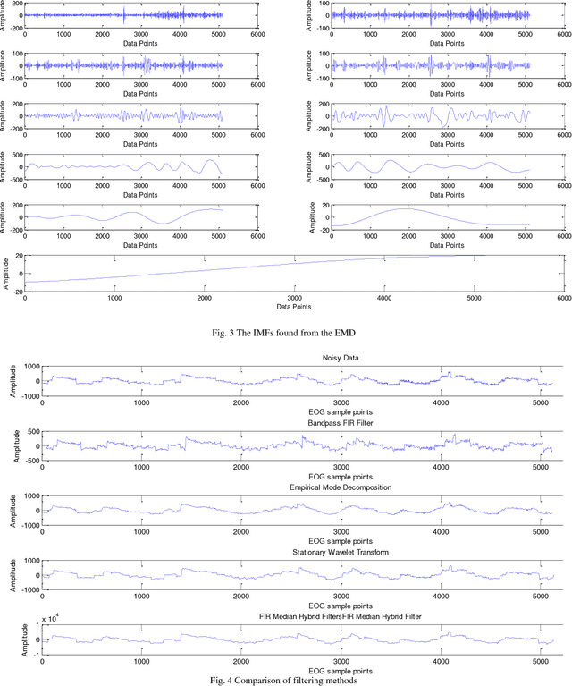 Figure 3 for Evaluation of Denoising Techniques for EOG signals based on SNR Estimation