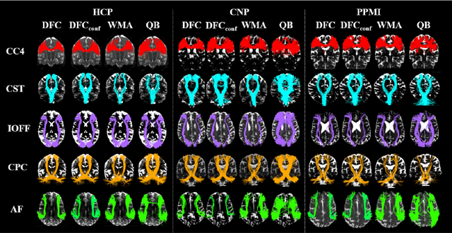 Figure 2 for DFC: Anatomically Informed Fiber Clustering with Self-supervised Deep Learning for Fast and Effective Tractography Parcellation