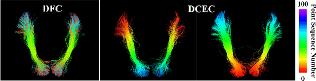 Figure 4 for DFC: Anatomically Informed Fiber Clustering with Self-supervised Deep Learning for Fast and Effective Tractography Parcellation