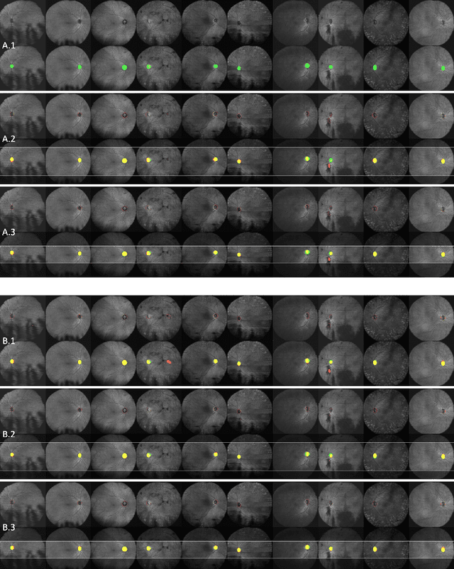 Figure 2 for Data-centric AI approach to improve optic nerve head segmentation and localization in OCT en face images