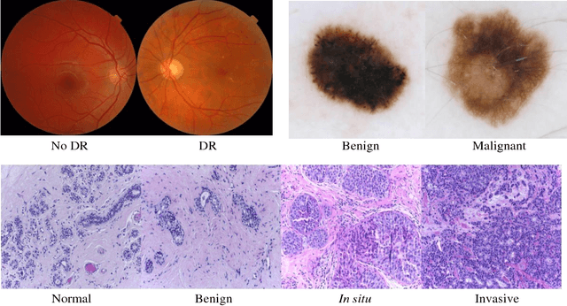 Figure 3 for MedAL: Deep Active Learning Sampling Method for Medical Image Analysis