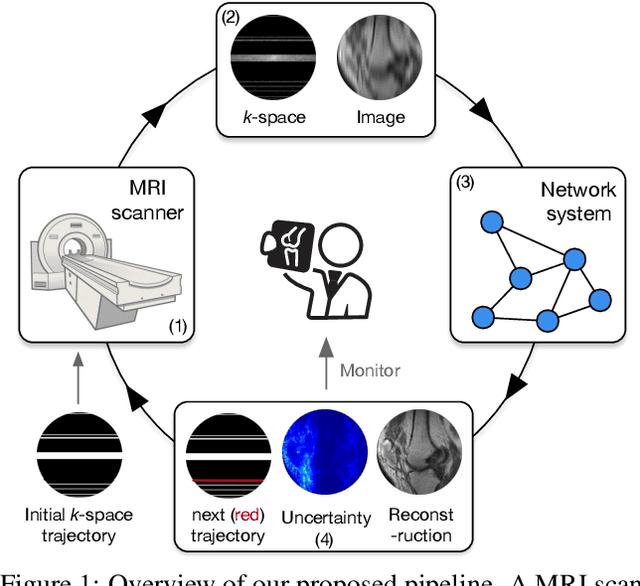 Figure 1 for Reducing Uncertainty in Undersampled MRI Reconstruction with Active Acquisition