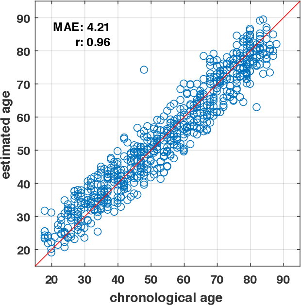 Figure 4 for Estimating brain age based on a healthy population with deep learning and structural MRI