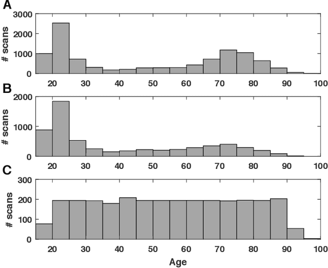 Figure 1 for Estimating brain age based on a healthy population with deep learning and structural MRI