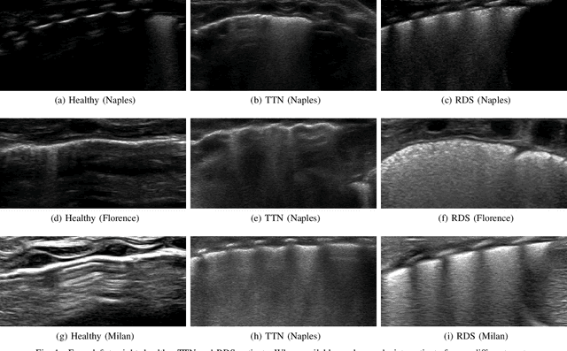 Figure 1 for Deep learning in the ultrasound evaluation of neonatal respiratory status