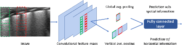 Figure 2 for Deep learning in the ultrasound evaluation of neonatal respiratory status