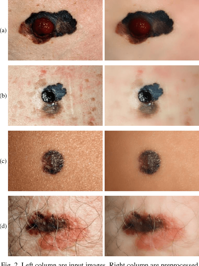 Figure 2 for Extraction of Skin Lesions from Non-Dermoscopic Images Using Deep Learning