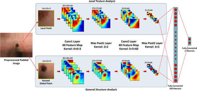 Figure 3 for Extraction of Skin Lesions from Non-Dermoscopic Images Using Deep Learning