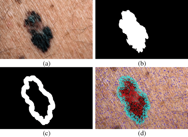 Figure 4 for Extraction of Skin Lesions from Non-Dermoscopic Images Using Deep Learning