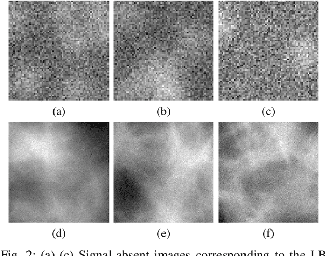 Figure 2 for Approximating the Ideal Observer for joint signal detection and localization tasks by use of supervised learning methods