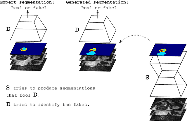 Figure 1 for Adversarial Networks for the Detection of Aggressive Prostate Cancer