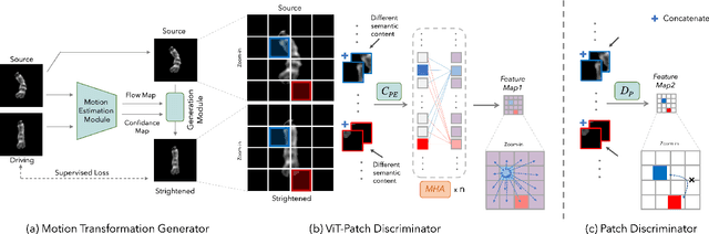 Figure 1 for A Robust Framework of Chromosome Straightening with ViT-Patch GAN