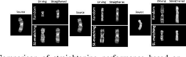 Figure 3 for A Robust Framework of Chromosome Straightening with ViT-Patch GAN