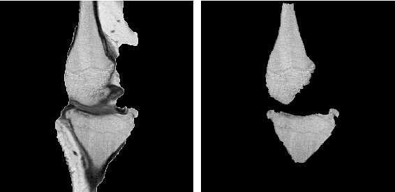Figure 4 for An Interactive Medical Image Segmentation Framework Using Iterative Refinement