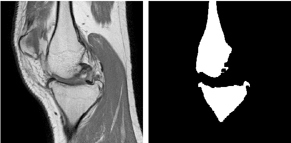 Figure 1 for An Interactive Medical Image Segmentation Framework Using Iterative Refinement