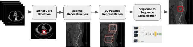 Figure 1 for 3D Convolutional Sequence to Sequence Model for Vertebral Compression Fractures Identification in CT