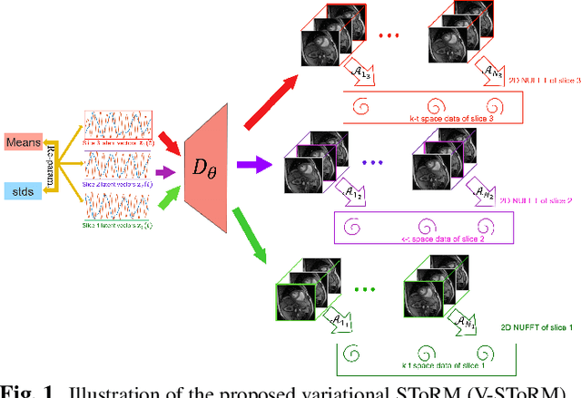 Figure 1 for Joint alignment and reconstruction of multislice dynamic MRI using variational manifold learning