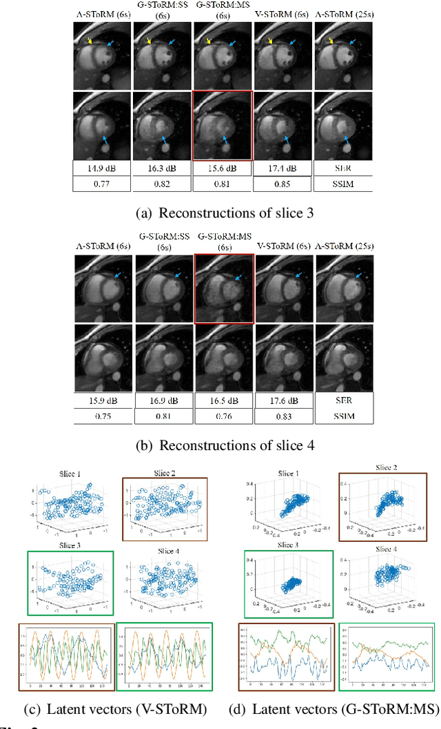 Figure 2 for Joint alignment and reconstruction of multislice dynamic MRI using variational manifold learning