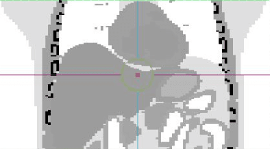 Figure 1 for Dynamic Cell Imaging in PET with Optimal Transport Regularization