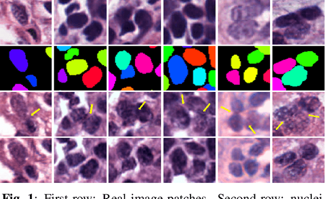 Figure 1 for Sharp-GAN: Sharpness Loss Regularized GAN for Histopathology Image Synthesis