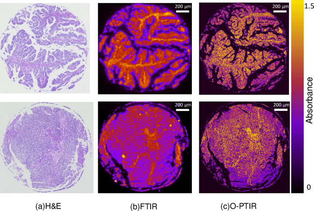 Figure 1 for Leveraging high-resolution spatial features in mid-infrared spectroscopic imaging to classify tissue subtypes in ovarian cancer