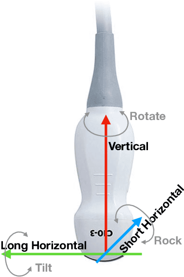 Figure 3 for Straight to the point: reinforcement learning for user guidance in ultrasound