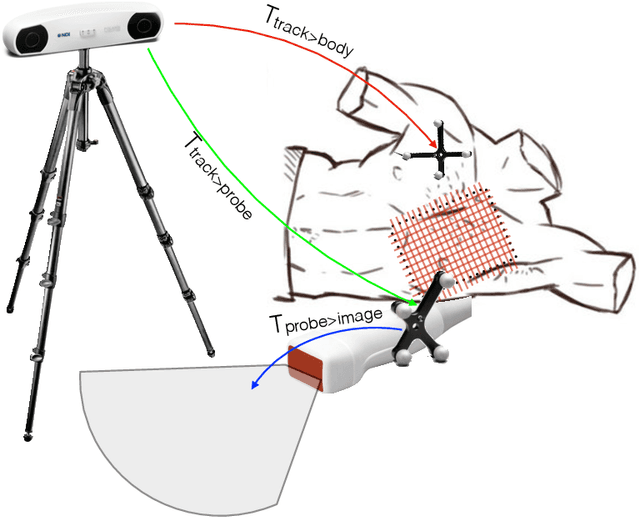 Figure 4 for Straight to the point: reinforcement learning for user guidance in ultrasound