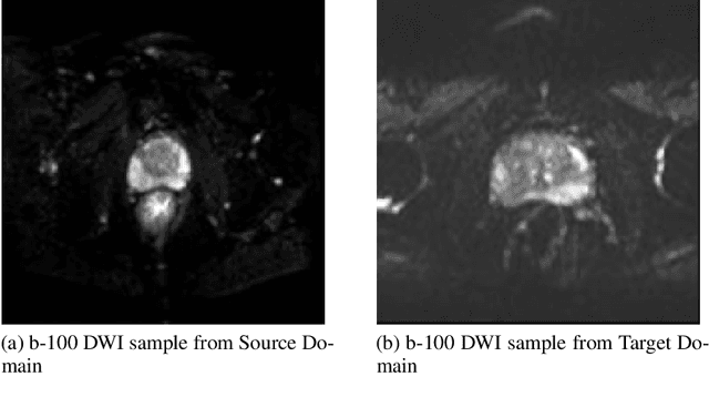 Figure 1 for A Transfer Learning Approach for Automated Segmentation of Prostate Whole Gland and Transition Zone in Diffusion Weighted MRI