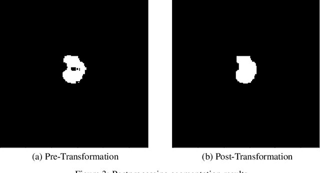 Figure 4 for A Transfer Learning Approach for Automated Segmentation of Prostate Whole Gland and Transition Zone in Diffusion Weighted MRI