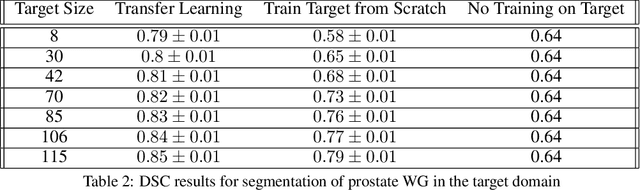 Figure 3 for A Transfer Learning Approach for Automated Segmentation of Prostate Whole Gland and Transition Zone in Diffusion Weighted MRI