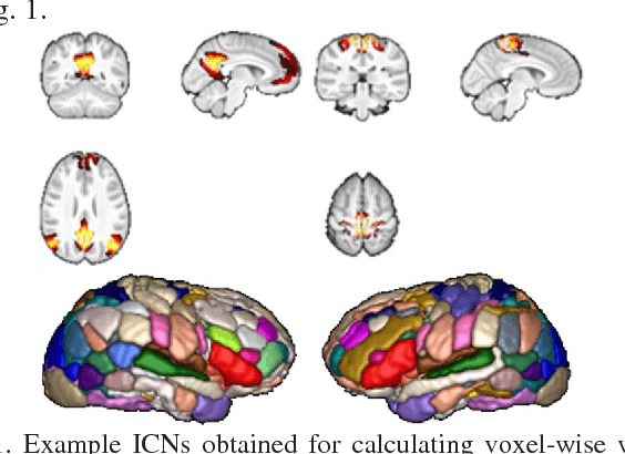 Figure 1 for Brain Age Prediction Based on Resting-State Functional Connectivity Patterns Using Convolutional Neural Networks