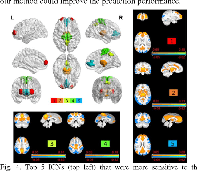 Figure 4 for Brain Age Prediction Based on Resting-State Functional Connectivity Patterns Using Convolutional Neural Networks