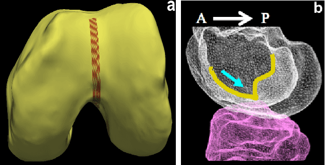 Figure 2 for Learning-Based Cost Functions for 3D and 4D Multi-Surface Multi-Object Segmentation of Knee MRI: Data from the Osteoarthritis Initiative