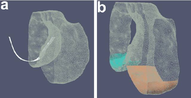 Figure 3 for Learning-Based Cost Functions for 3D and 4D Multi-Surface Multi-Object Segmentation of Knee MRI: Data from the Osteoarthritis Initiative