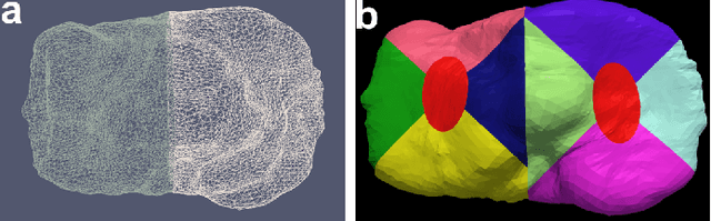 Figure 4 for Learning-Based Cost Functions for 3D and 4D Multi-Surface Multi-Object Segmentation of Knee MRI: Data from the Osteoarthritis Initiative