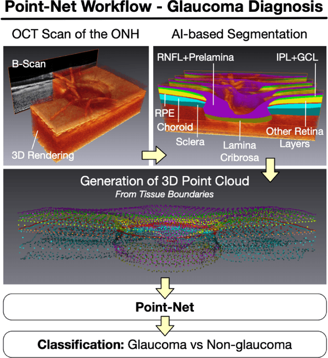 Figure 2 for Medical Application of Geometric Deep Learning for the Diagnosis of Glaucoma