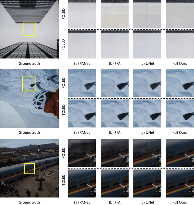 Figure 4 for Deep Atrous Guided Filter for Image Restoration in Under Display Cameras