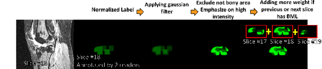 Figure 1 for Weakly Supervised Medical Image Segmentation With Soft Labels and Noise Robust Loss