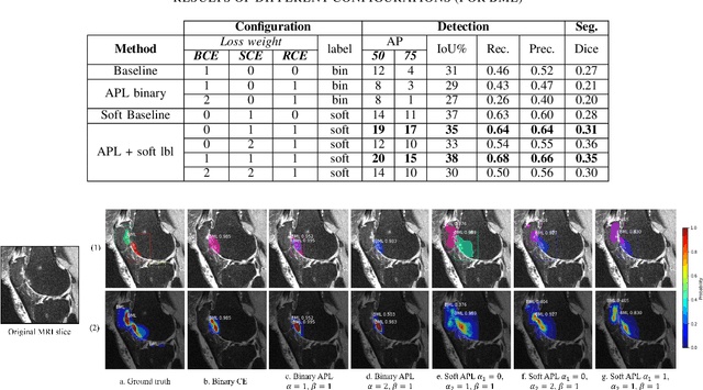 Figure 2 for Weakly Supervised Medical Image Segmentation With Soft Labels and Noise Robust Loss