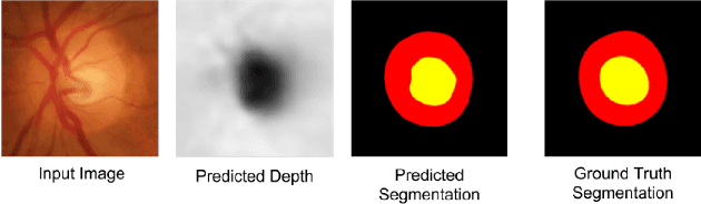 Figure 1 for Fully Convolutional Networks for Monocular Retinal Depth Estimation and Optic Disc-Cup Segmentation