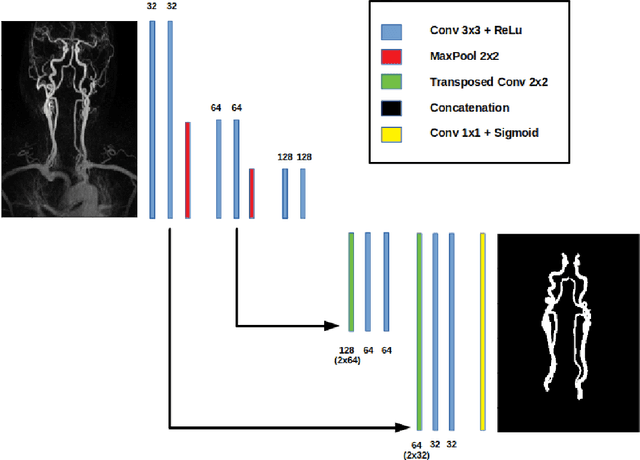 Figure 4 for Projection-Based 2.5D U-net Architecture for Fast Volumetric Segmentation