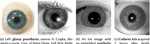 Figure 3 for Presentation Attack Detection for Iris Recognition: An Assessment of the State of the Art